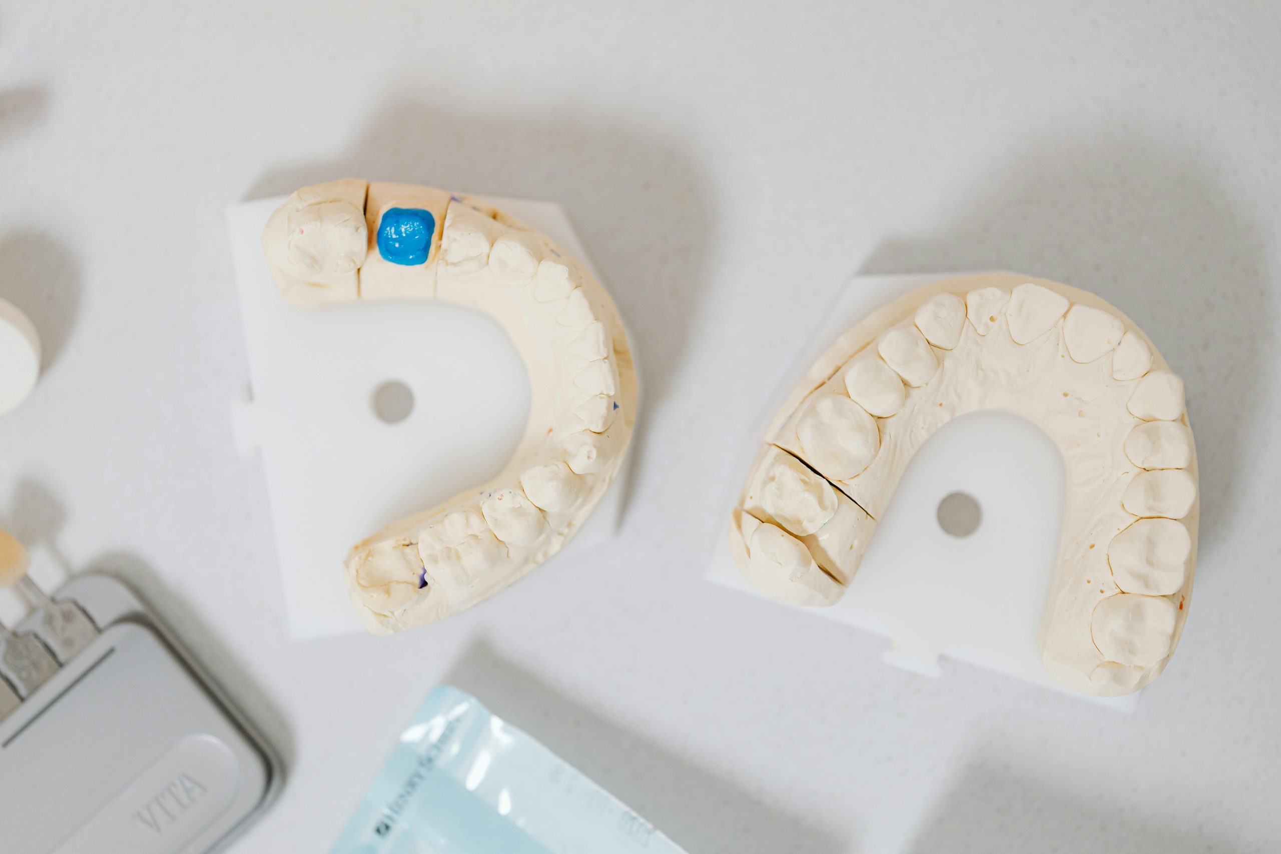 All About Crowns: A Simple Guide from Burnaby South Dental