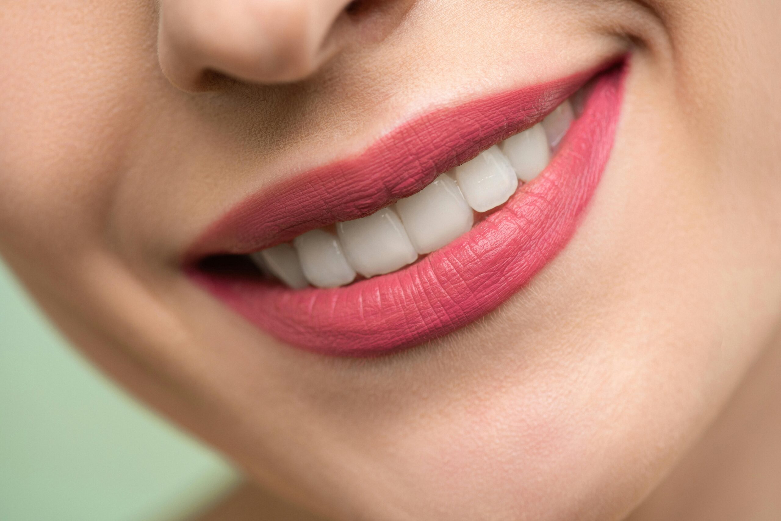Teeth Whitening in Burnaby: Professional vs. At-Home — A Dentist’s Honest Guide